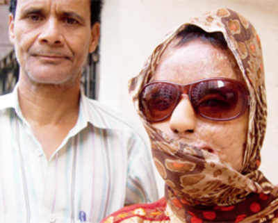 14 years on, two convicted in acid attack case get 15 days in jail