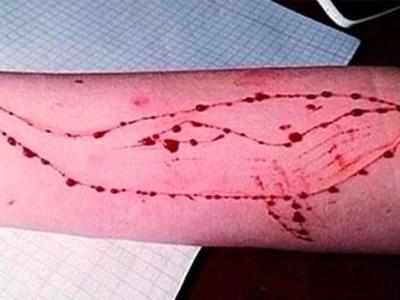 Supreme Court seeks govt's reply on plea to firewall Blue Whale game