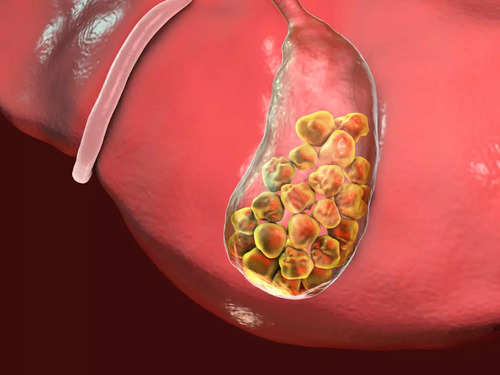 Acid reflux vs. gallstones: How to determine the pain in the upper 