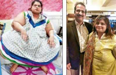 ‘Indian Eman’ weighs 125kg post bariatric operation