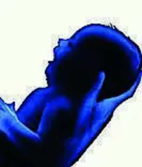 PMC sends notice to hospital on newborn’s death after C-section