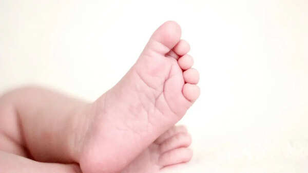 Tanzanian baby with rare skull deformity gets new lease of life in Delhi