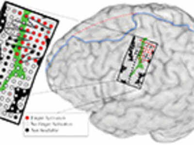 Mind-controlled prosthetic arm moves individual ‘fingers’