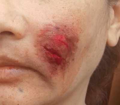 Woman fights off her predator, left with brutal bites