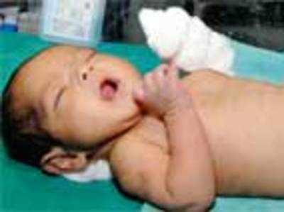 Nurse severs baby’s thumb in Chitradurga