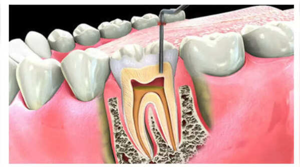 Infection can enter the bloodstream