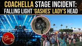 Coachella Stage Incident: Falling Light &lsquo;Gashes&rsquo; Head, Show Abruptly Stopped