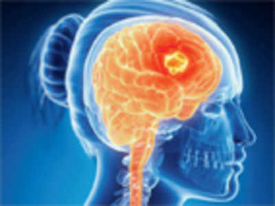 IISc finds way to bust brain cancer