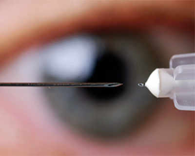 Tiny needles offer treatment for two major eye diseases