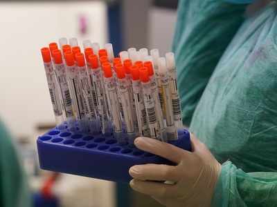 One private lab in Maharashtra stopped from conducting COVID-19 tests