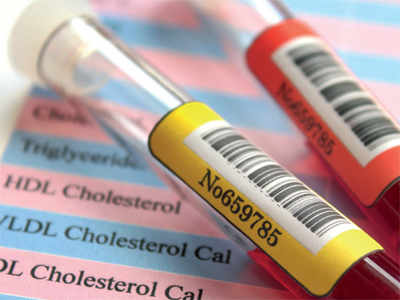 Cholesterol: Good, bad, unknown
