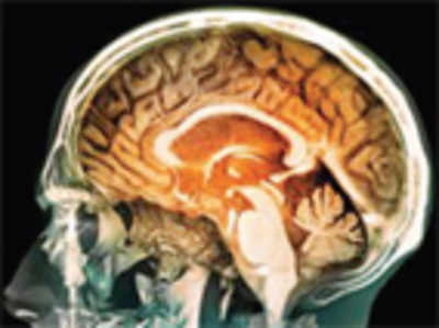 IISc researchers find easier way to detect brain tumours