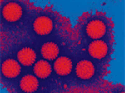 A quicker method to identify virus that cause diarrhoea