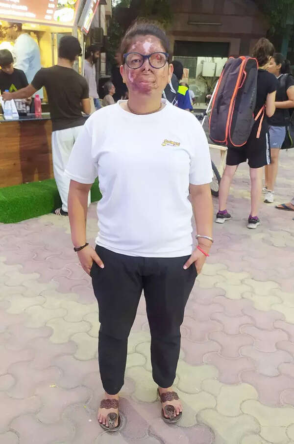 'When I first saw my face after attack, I felt like dying'