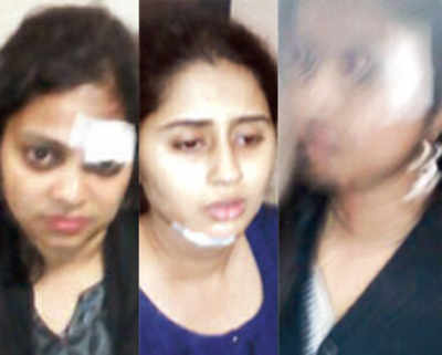 3 women hit by stones while travelling on trains