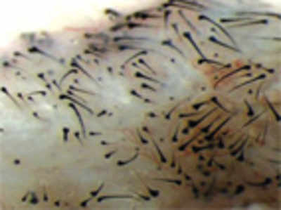 Scientists use stem cells to grow new hair