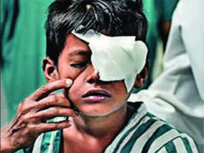 Four boys injured in cracker accidents