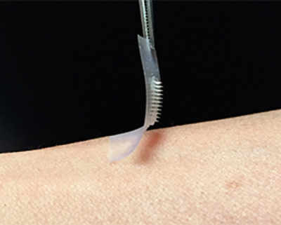 Smart insulin to replace daily jabs for diabetics