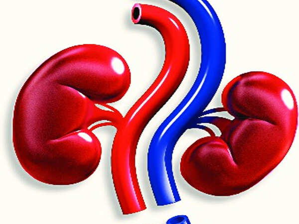 SSH completes 50 kidney transplants