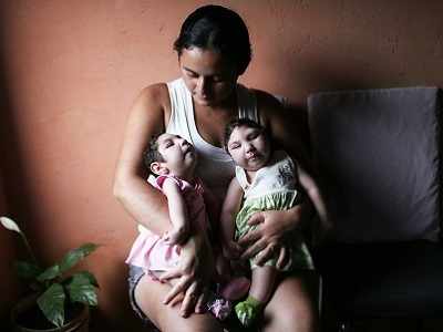 Scientists decode how Zika virus causes microcephaly