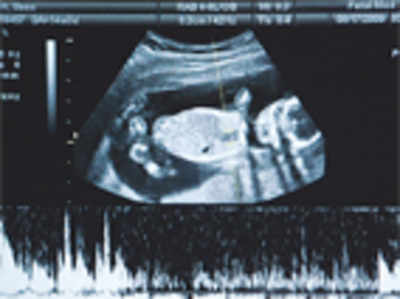 The female foetus has a new bodyguard, and it is tech-savvy