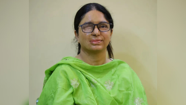 ‘Rs 20 worth of acid can destroy an entire life…glad SC has recognised the urgency’