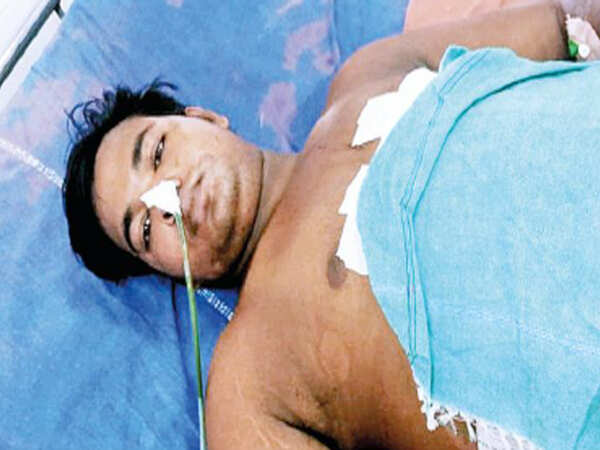UP man falls from train, walks over 9km with his intestines out
