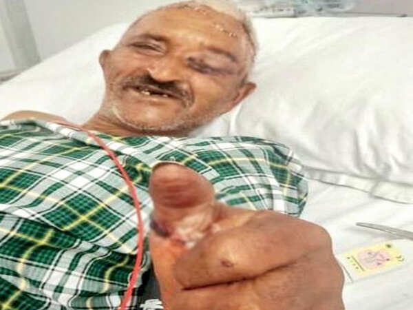 Rare surgical re-implantation performed in Mount Abu