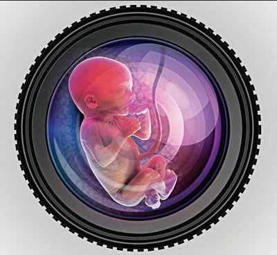 Sangli foeticide case: Probe reveals male foetuses were also aborted