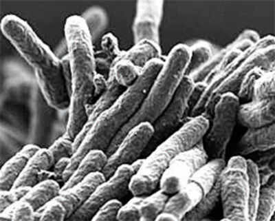 Antacid could treat TB
