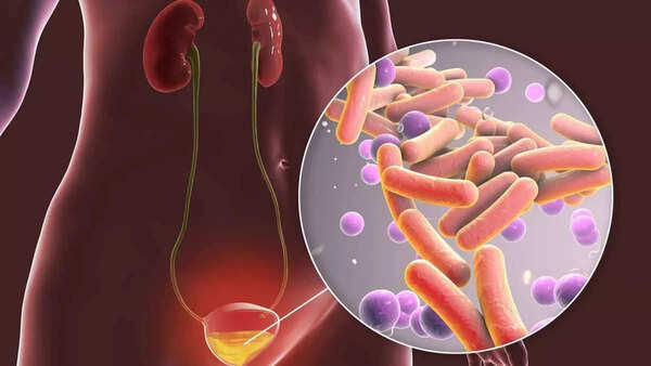 Dos and Don'ts for managing UTI