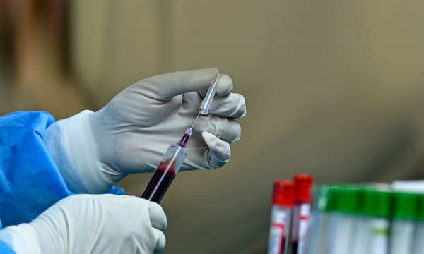 Which Covid test passes the test for accuracy?