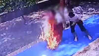 Karnataka: Woman's sari catches fire in temple in tragic accident, results in 60% burn injuries 