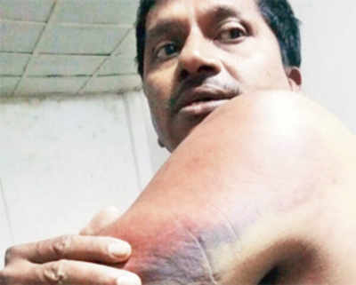 Andheri man thrashed in Mozambique sent home