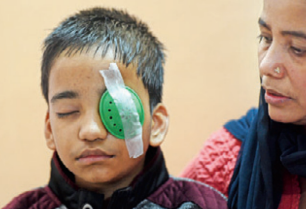 Thrashed by teacher, child may lose vision