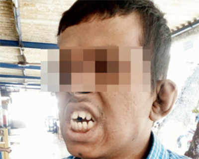 Deaf-and-mute man thrashed by caretaker