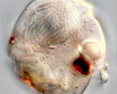 Single-celled predator evolves tiny, human-like ‘eye’