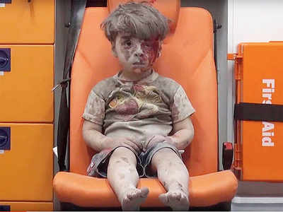 The face of Syrian war