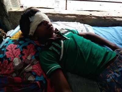 West Bengal: Minor boy takes a bullet in the eye as BSF and smugglers get into shootout in Malda village