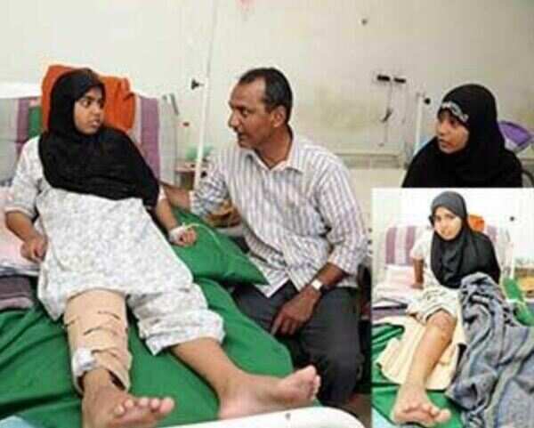 Teacher's punishment leaves 10-yr-old girl limping in pain
