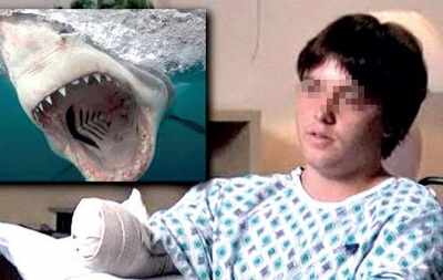Fake news buster: Activist Got his Arm Bitten Off After Hugging a great white Shark?