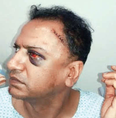 Versova businessman assaulted, robbed during New Year’s party