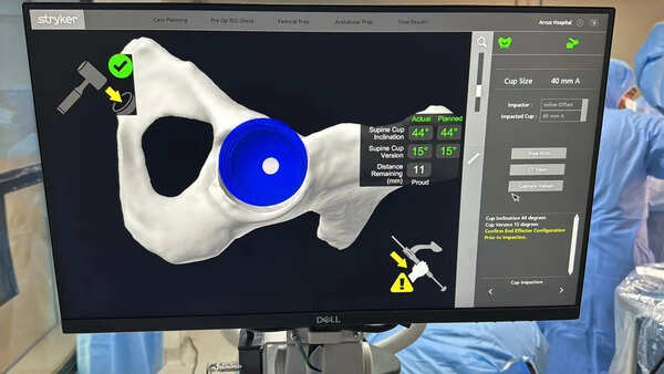 Robotic surgery saves businessman from hip replacement nightmare
