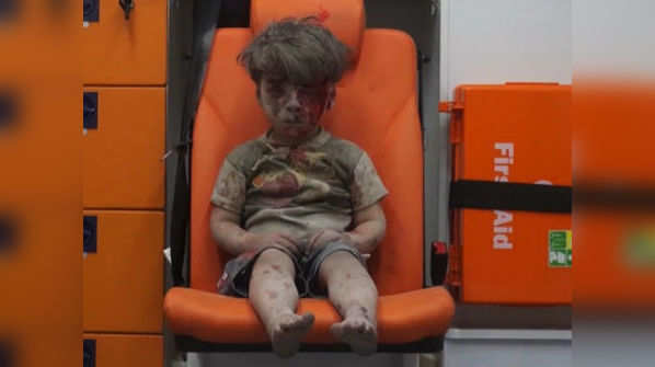 Omran Daqneesh