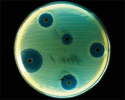 Bacterial resistance to antibiotics reversed