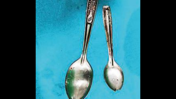 IGIMS docs remove spoons from L'sarai man's stomach