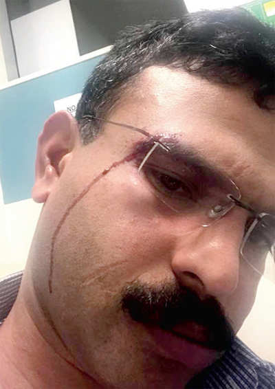 Keralite injured in racial attack