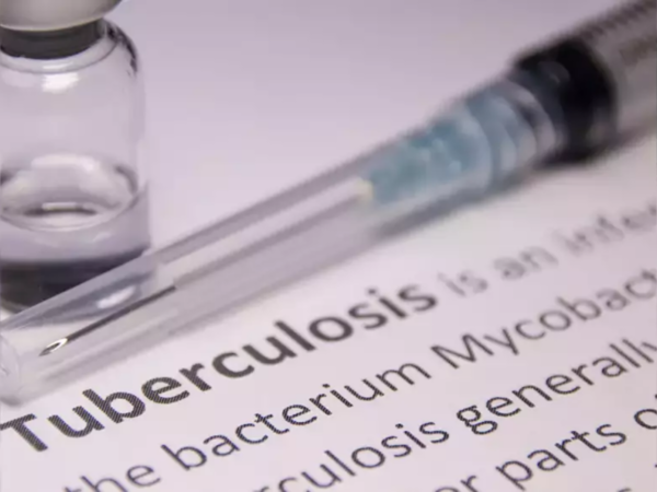 Pandemic year lowered TB transmission rates