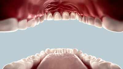 The impact on oral health