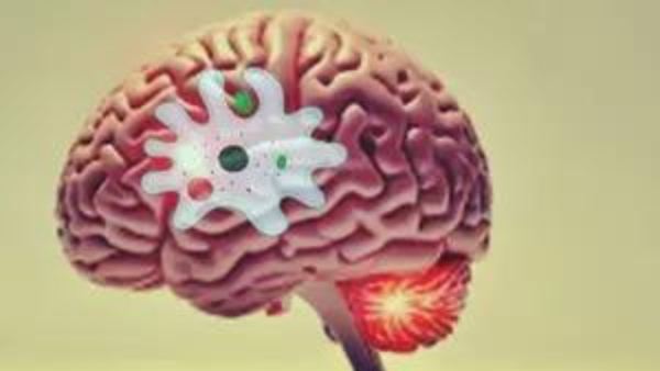 12- year- old boy dies of rare brain infection
